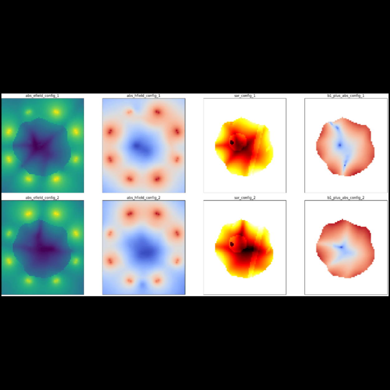 MRI Field Optimizer